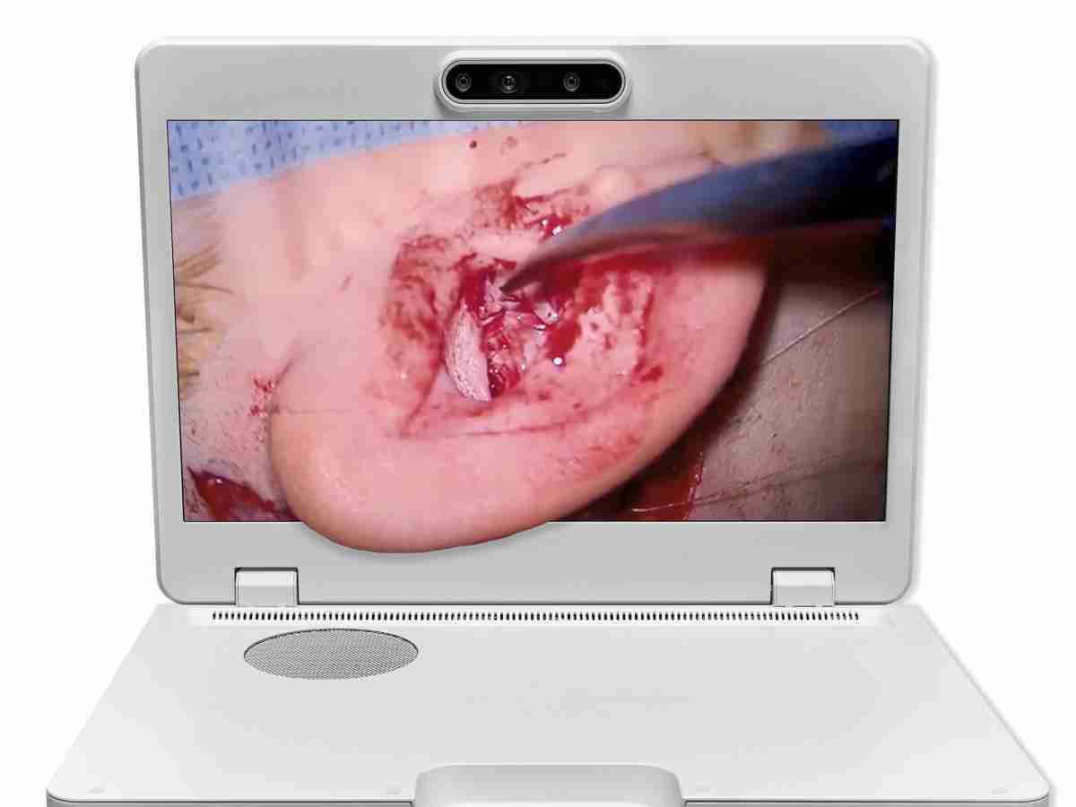 达擎之＂Heads-up 3D显微手术显示系统＂，，，整合4K裸眼3D显示及眼球追踪系统，，，具备快速追踪人眼移动位置功能，，，减轻医师长时间维持固定姿势的负担，，，让医师能有更宽广清晰的3D立体视野及更舒适的姿势来执行手术。。。